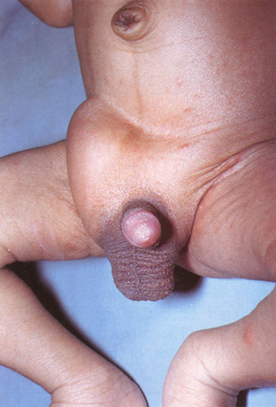 com.bmj.content.model.assessment.Caption@57b5633b