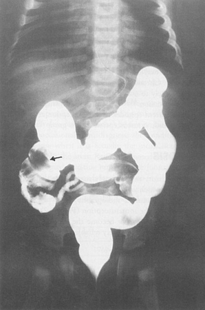 com.bmj.content.model.assessment.Caption@3abefb76