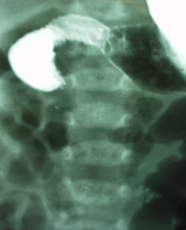 com.bmj.content.model.assessment.Caption@63d2755e