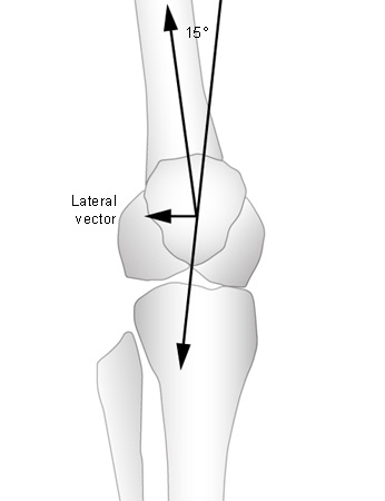 Patellofemoral pain syndrome images