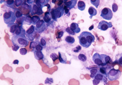 com.bmj.content.model.assessment.Caption@3e6254ac
