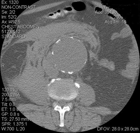 com.bmj.content.model.assessment.Caption@362dbad7