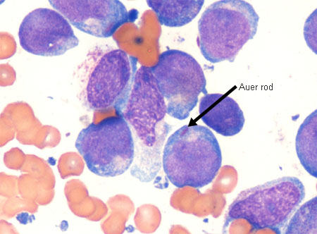 com.bmj.content.model.assessment.Caption@56ceaa71