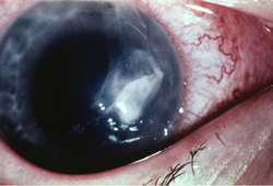 Assessment of vision loss images