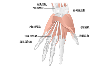 手部和腕部腱鞘炎 images