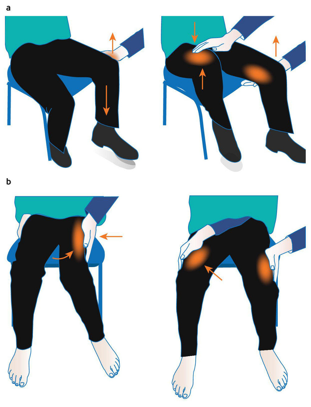 Functional neurological and somatic symptom disorders images