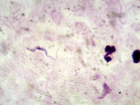 African trypanosomiasis images