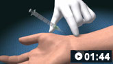 Radial artery puncture animated demonstration