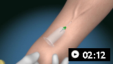 Venepuncture and phlebotomy: animated demonstration