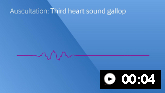 გულის მესამე ხმა-გალოპის რიტმი