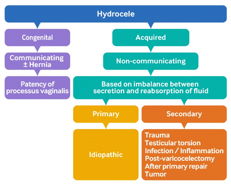 Hydrocele Symptoms Diagnosis And Treatment Bmj Best Practice Us