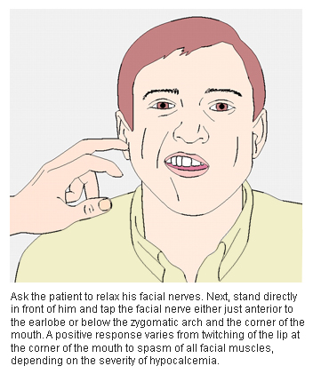 Pseudohypoparathyroidism Symptoms Diagnosis And Treatment Bmj Best Practice Us