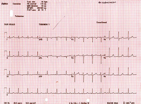 Evaluation of hypocalcemia - Images | BMJ Best Practice US