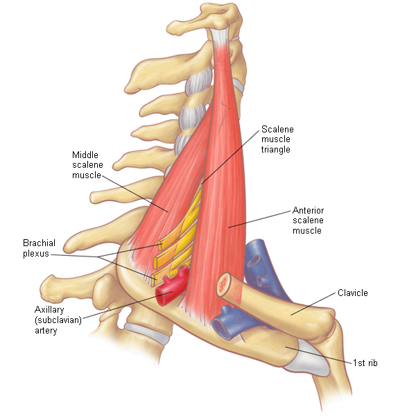 Thoracic outlet syndrome - Etiology | BMJ Best Practice US