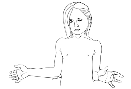 erb palsy symptoms diagnosis and treatment bmj best practice erb duchenne