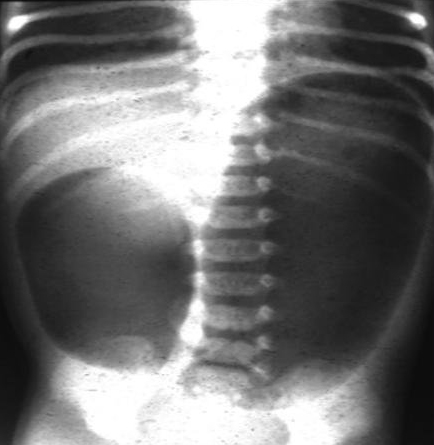 儿童腹痛的评估 诊断路径 Bmj Best Practice