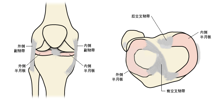 半月板断裂 症状 诊断和治疗 Bmj Best Practice