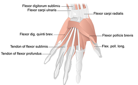 Tenosynovitis of the hand and wrist - Symptoms, diagnosis and treatment ...